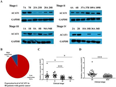 From mitochondria to tumor suppression: ACAT1's crucial role in gastric cancer